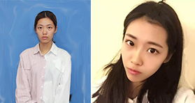 大媽臉變童顏少女臉，看我在廈門臉博士do了什么？