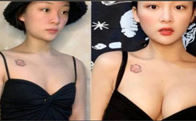 洛陽華美醫(yī)療美容醫(yī)院做假體隆胸怎么樣？看我就知道啦！