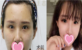 通過郭建玲眼綜合真人案例看北京京民是否正規(guī)靠譜？