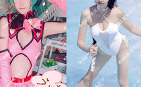 看:?雅美肖征剛隆胸案例和韓國(guó)蓓拉225假體隆胸恢復(fù)好圖片!