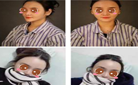 北京哪個醫(yī)生做脂肪修復(fù)好？愛多邦王紹國案例及價格分享