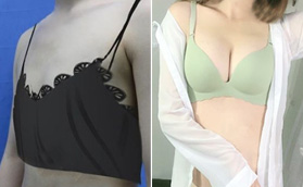 濟南韓氏整形醫(yī)院棉花糖豐胸對比圖組